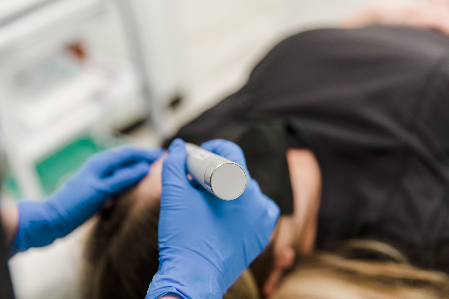 1. Microneedling